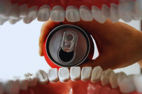 "Illustration of a soda can pressed between teeth, symbolizing the harmful effects of drinking soda after wisdom teeth removal."