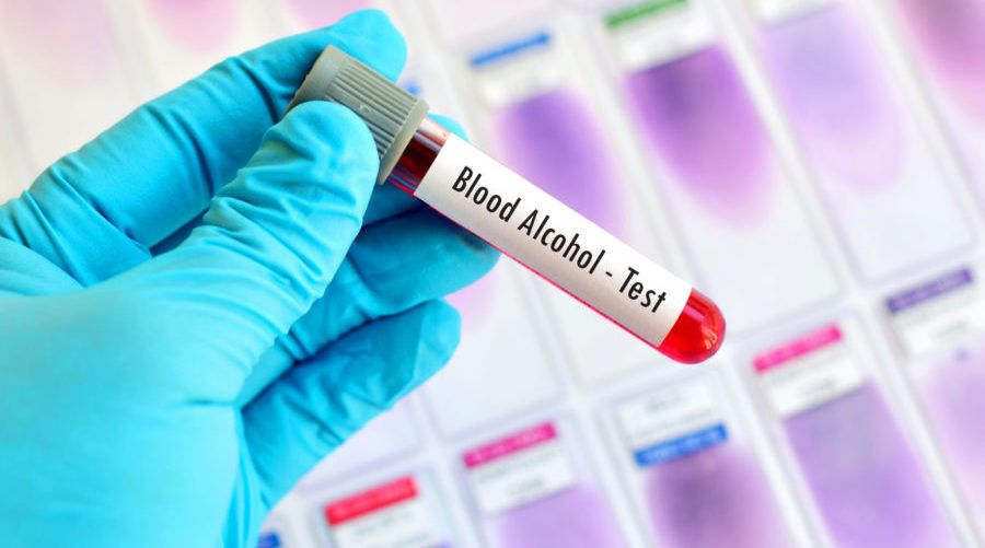 A healthcare professional holding a blood sample labeled blood alcohol test, representing PEth testing that can detect occasional drinking and recent alcohol use.